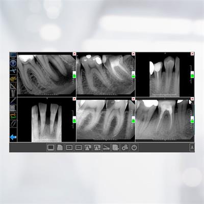 Xline Wall Mount X-ray PN: XDC